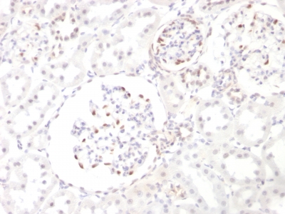 Formalin-fixed, paraffin embedded rat kidney sections stained with 100 ul anti-Wilms Tumor 1 (clone WT1/857) at 1:300. HIER epitope retrieval prior to staining was performed in 10mM Citrate, pH 6.0.